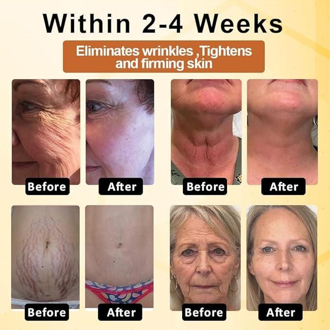 Botox Bee Advanced Multi-Action Firming Cream ā 200gm Each (Pack of 2)