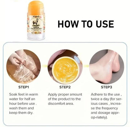 Hand &amp; Foot Roll-On | For Dryness &amp; Rough Skin – 40gm