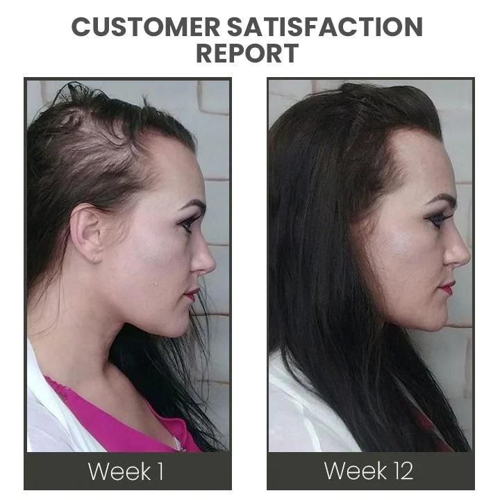 Hair Stimulating Spray Max – Hair Growth &amp; Thickening Treatment (60ml Each) – Pack of 2